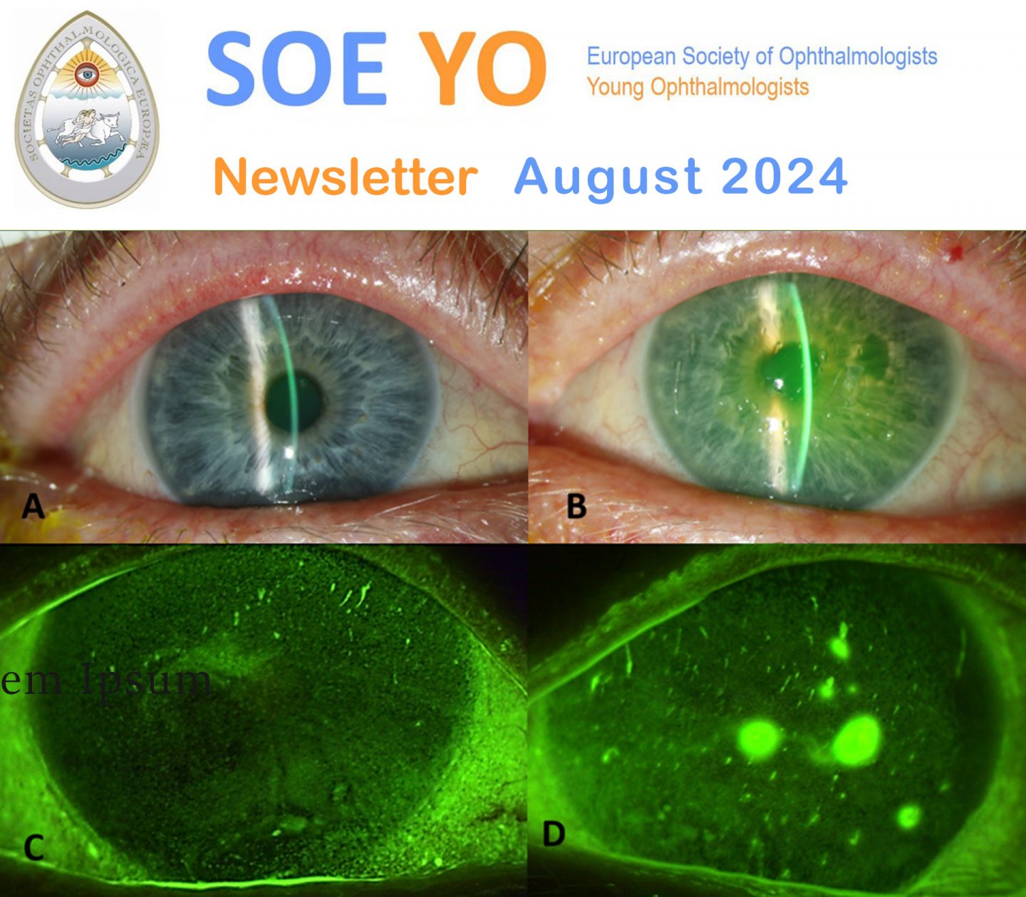 SOE Latest YO Newsletter